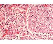 Managing Legionella in Facilities