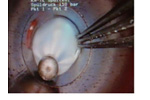 Operation Of The Sewer System After FAST Installation